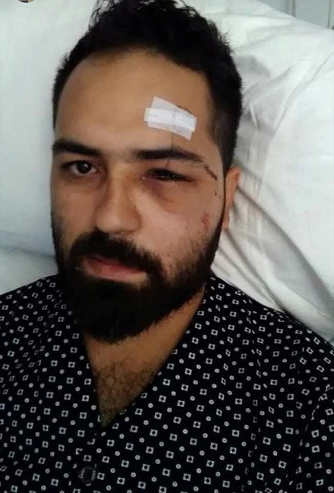 15 Temmuz Gazisi Akkoç: "Darbeci asker dalga geçer bir ses tonu ile ‘sen kelime-i şehadet getir’ dedi"