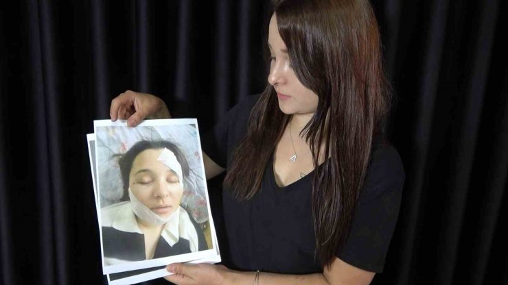 Eski sevgilisi tarafından öldüresiye darp edilen genç kadın yaşadığı kâbusu anlattı