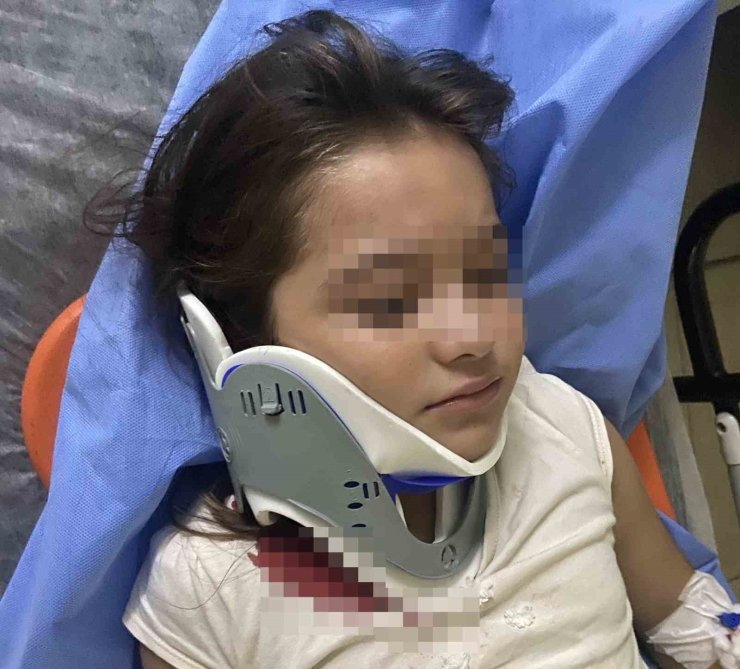 Ordu’da ters şeritten gelen scooter, 8 yaşındaki çocuğa çarptı