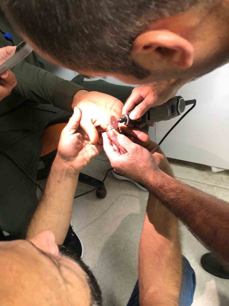 Mardin’de bir kişinin parmağında sıkışan yüzük itfaiye ekiplerince çıkartıldı