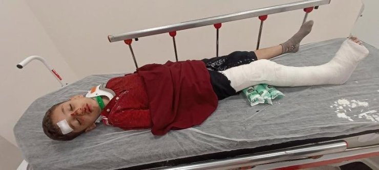 Başakşehir’de 8 yaşındaki çocuğa trafiğe kapalı alanda motosiklet çarptı: Baba yardım istedi