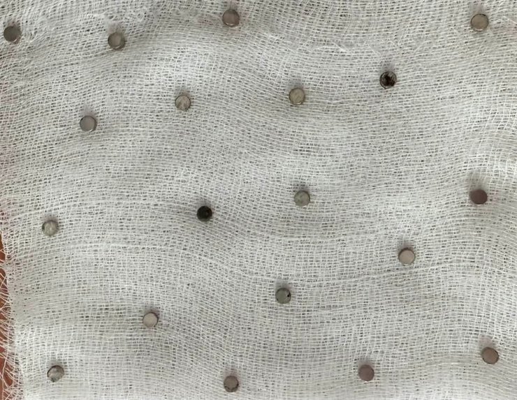 Çocuğun boğazından 19 adet mıknatıs çıkartıldı