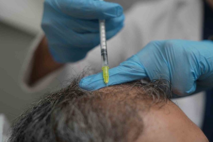 Dökülen saçlar vücudun bir alarmı olabilir