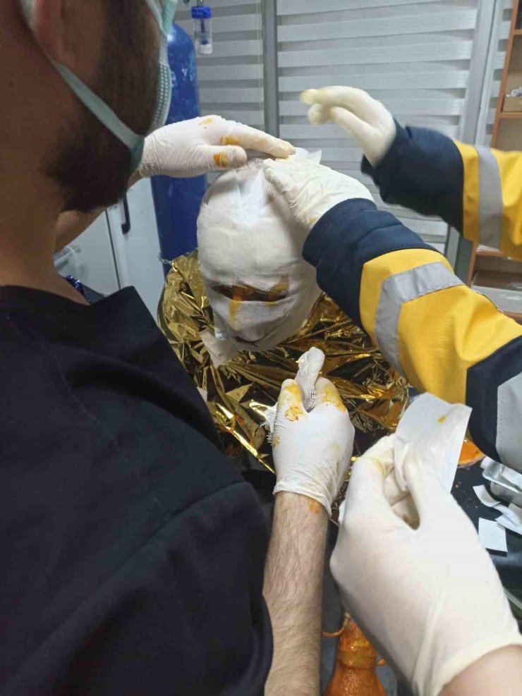 Erzincan’da kömür ocağında yangın: 2 işçi yaralı