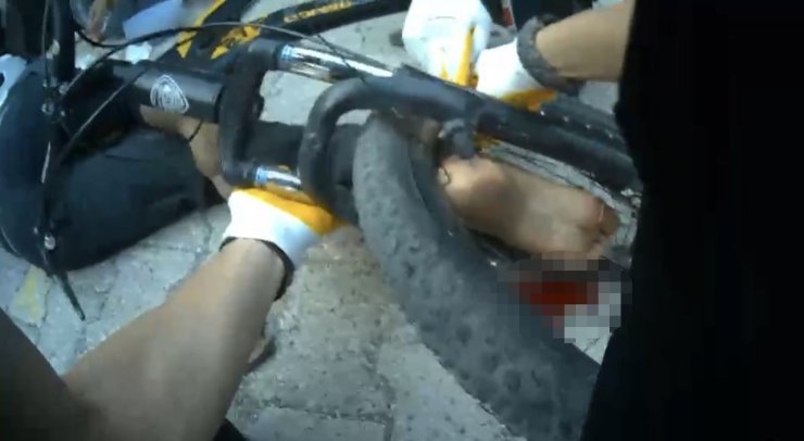 Osmaniye’de ayağı bisikletin tekerine sıkışan çocuk ekiplerce kurtarıldı