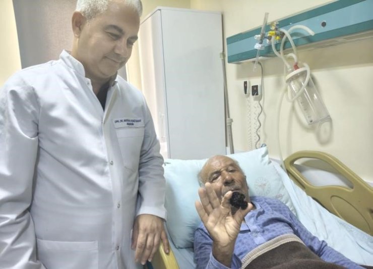 Bozyazı’da 4 santimetrelik mesane taşı tek parça halinde çıkarıldı.