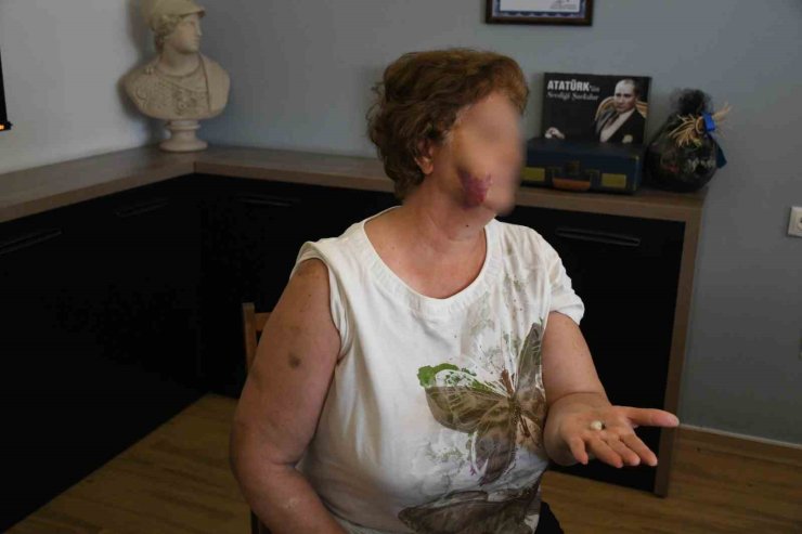 Kuşadası’nda ev kavgası kanlı bitti: Anne ve iki çocuğu bıçaklandı